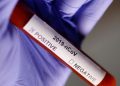 Rezultat negativ la testul pentru coronavirus în cazul bărbatului din Alexandria