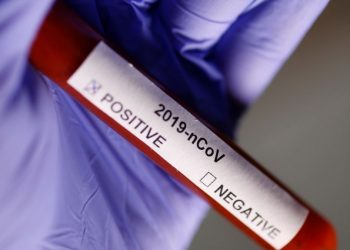 Rezultat negativ la testul pentru coronavirus în cazul bărbatului din Alexandria