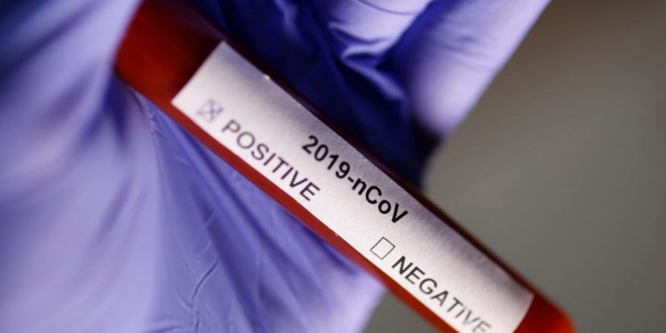 Rezultat negativ la testul pentru coronavirus în cazul bărbatului din Alexandria