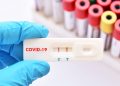Număr redus de noi îmbolnăviri cu Covid. Testarea antigen influențează cifrele oficiale