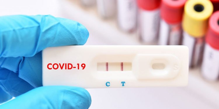 Număr redus de noi îmbolnăviri cu Covid. Testarea antigen influențează cifrele oficiale